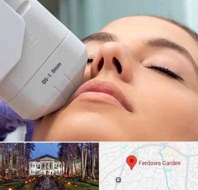 هایفوتراپی در باغ فردوس