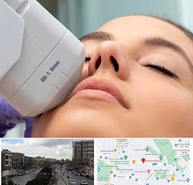 هایفوتراپی در بلوار فردوسی مشهد