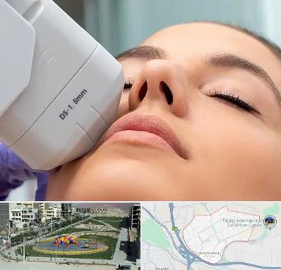 هایفوتراپی در مرزداران تبریز