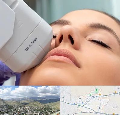 هایفوتراپی در رودهن