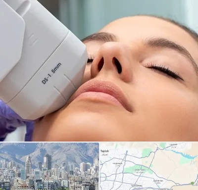 هایفوتراپی در شمال شرق تهران