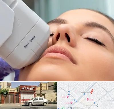 هایفوتراپی در باجک قم