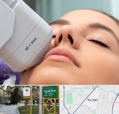 هایفوتراپی در تهران ویلا