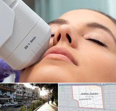 هایفوتراپی در خیابان جمالزاده