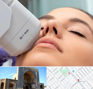 هایفوتراپی در مصلی مشهد