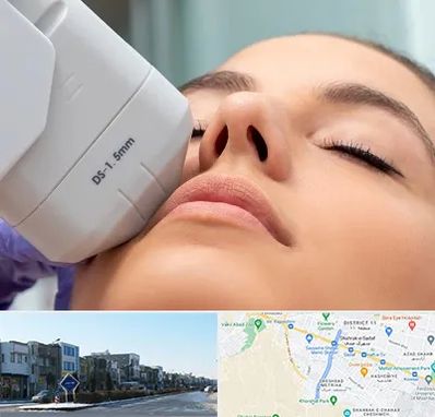 هایفوتراپی در شریعتی مشهد