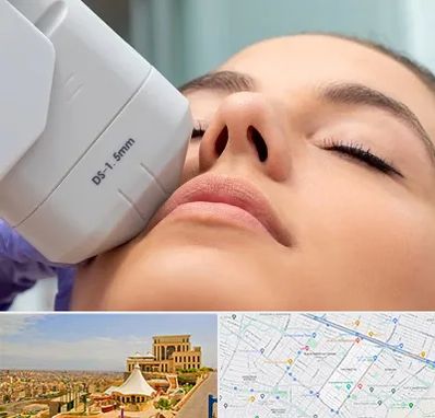 هایفوتراپی در هاشمیه مشهد