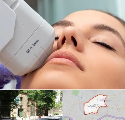 هایفوتراپی در دزاشیب