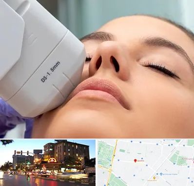 هایفوتراپی در بلوار سجاد مشهد