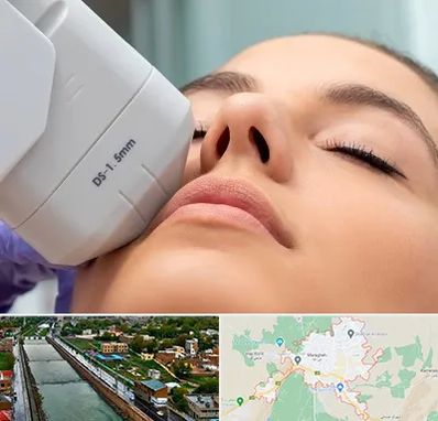 هایفوتراپی در مراغه