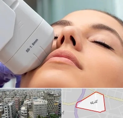هایفوتراپی در آذری