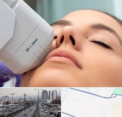 هایفوتراپی در بلوار ارتش