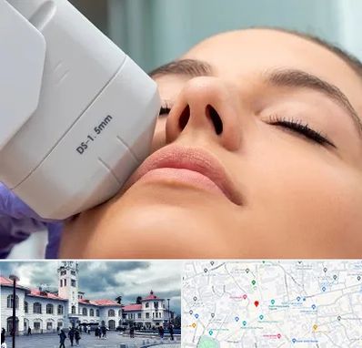 هایفوتراپی در میدان شهرداری رشت