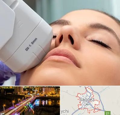 هایفوتراپی در سقز