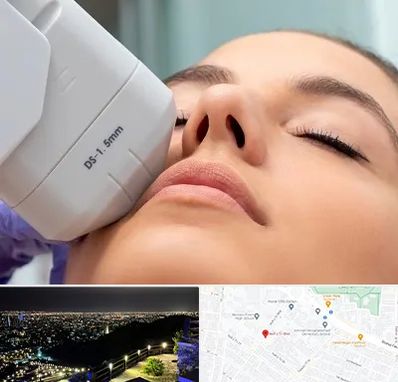 هایفوتراپی در هفت تیر مشهد