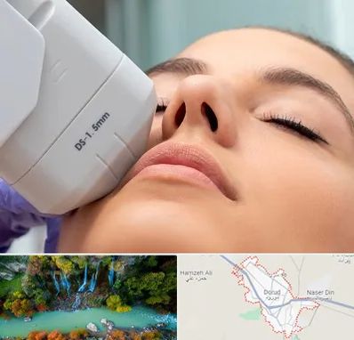 هایفوتراپی در دورود