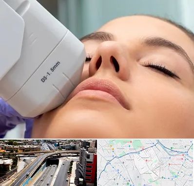 هایفوتراپی در ستارخان شیراز