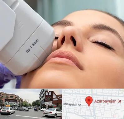 هایفوتراپی در خیابان آذربایجان