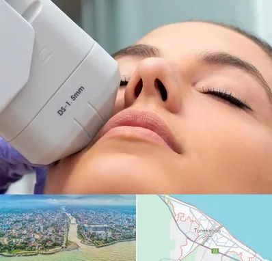 هایفوتراپی در تنکابن