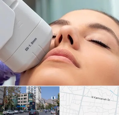 هایفوتراپی در کامرانیه