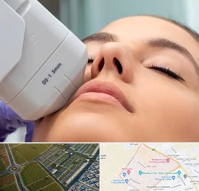 هایفوتراپی در الهیه مشهد