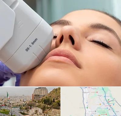 هایفوتراپی در فرهنگ شهر شیراز