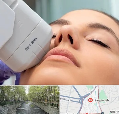 هایفوتراپی در زرگنده