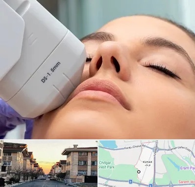 هایفوتراپی در کوهک