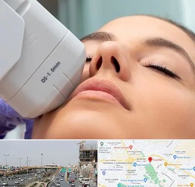 هایفوتراپی در بلوار توس مشهد