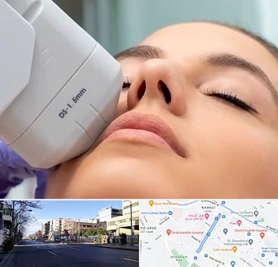 هایفوتراپی در خیابان ملاصدرا شیراز