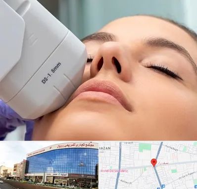 هایفوتراپی در نصف راه تبریز