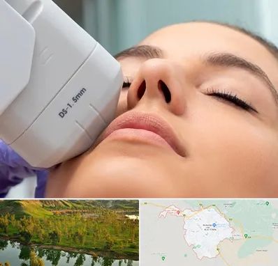 هایفوتراپی در بهبهان