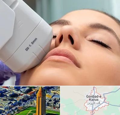 هایفوتراپی در گنبد کاووس