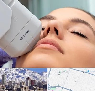 هایفوتراپی در ازگل