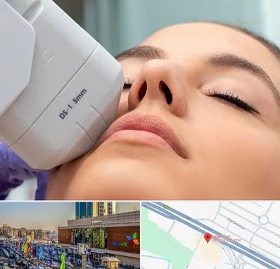 هایفوتراپی در لاله پارک تبریز