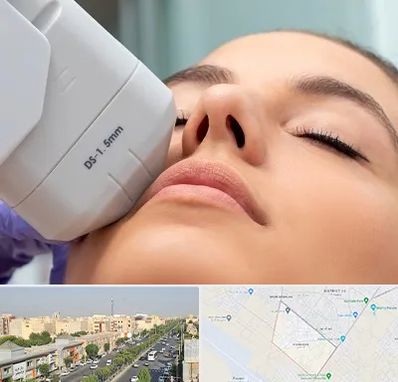 هایفوتراپی در کیانمهر کرج