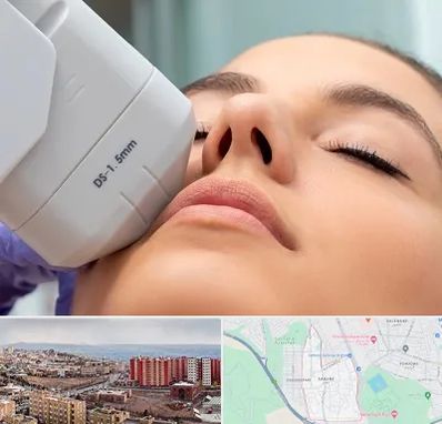 هایفوتراپی در سهند تبریز