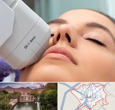 هایفوتراپی در دامغان