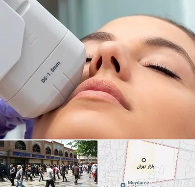 هایفوتراپی در بازار تهران
