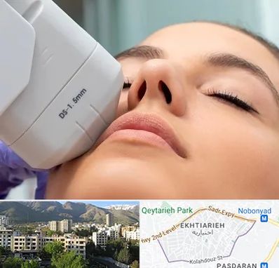 هایفوتراپی در اختیاریه 