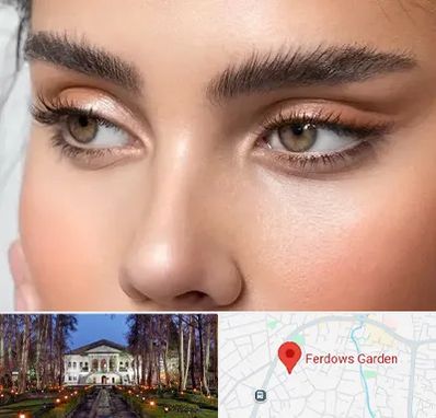 کانتو پلاستی در باغ فردوس