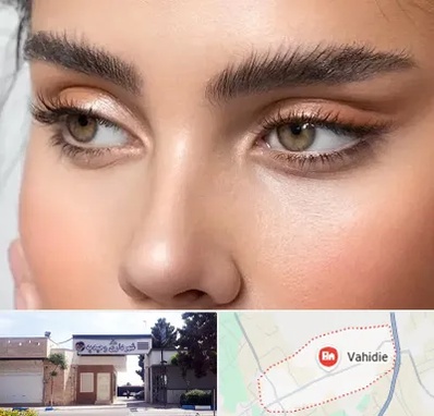 کانتو پلاستی در وحیدیه شهریار