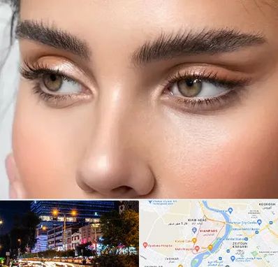 کانتو پلاستی در کیانپارس اهواز