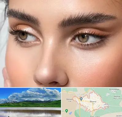 کانتو پلاستی در مرند