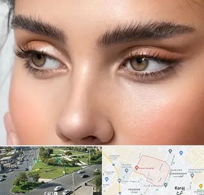 کانتو پلاستی در شاهین ویلا کرج