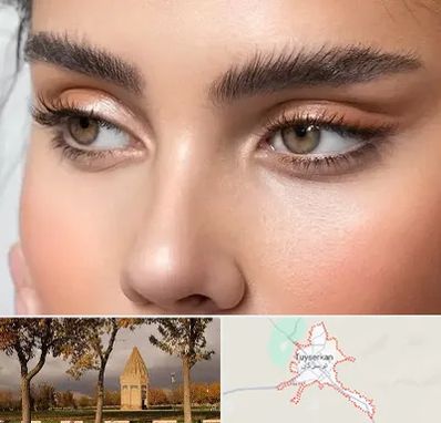 کانتو پلاستی در تویسرکان