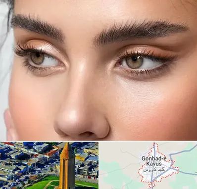 کانتو پلاستی در گنبد کاووس