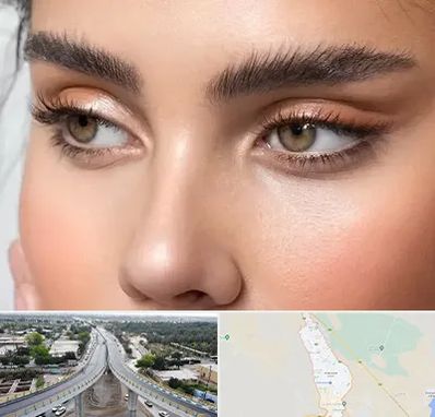 کانتو پلاستی در اندیمشک