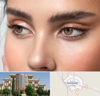 کانتو پلاستی در دهدشت