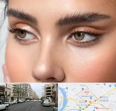 کانتو پلاستی در زیتون کارمندی اهواز